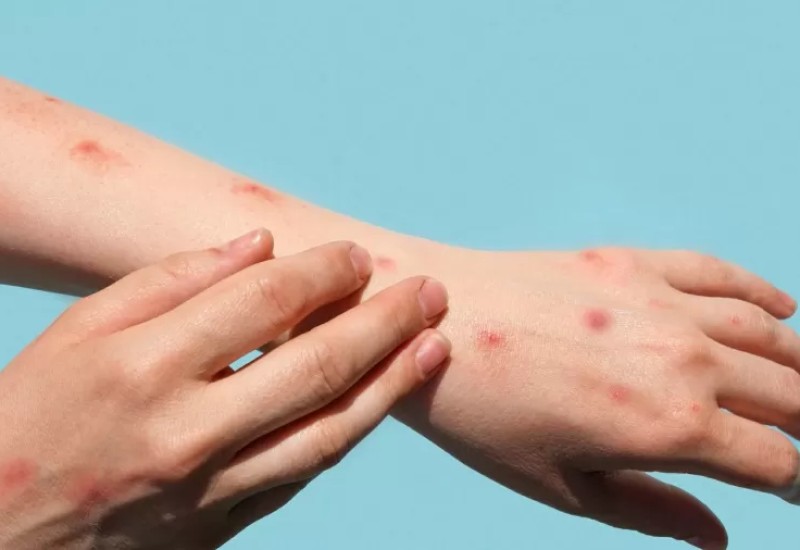 Imagem: iStock